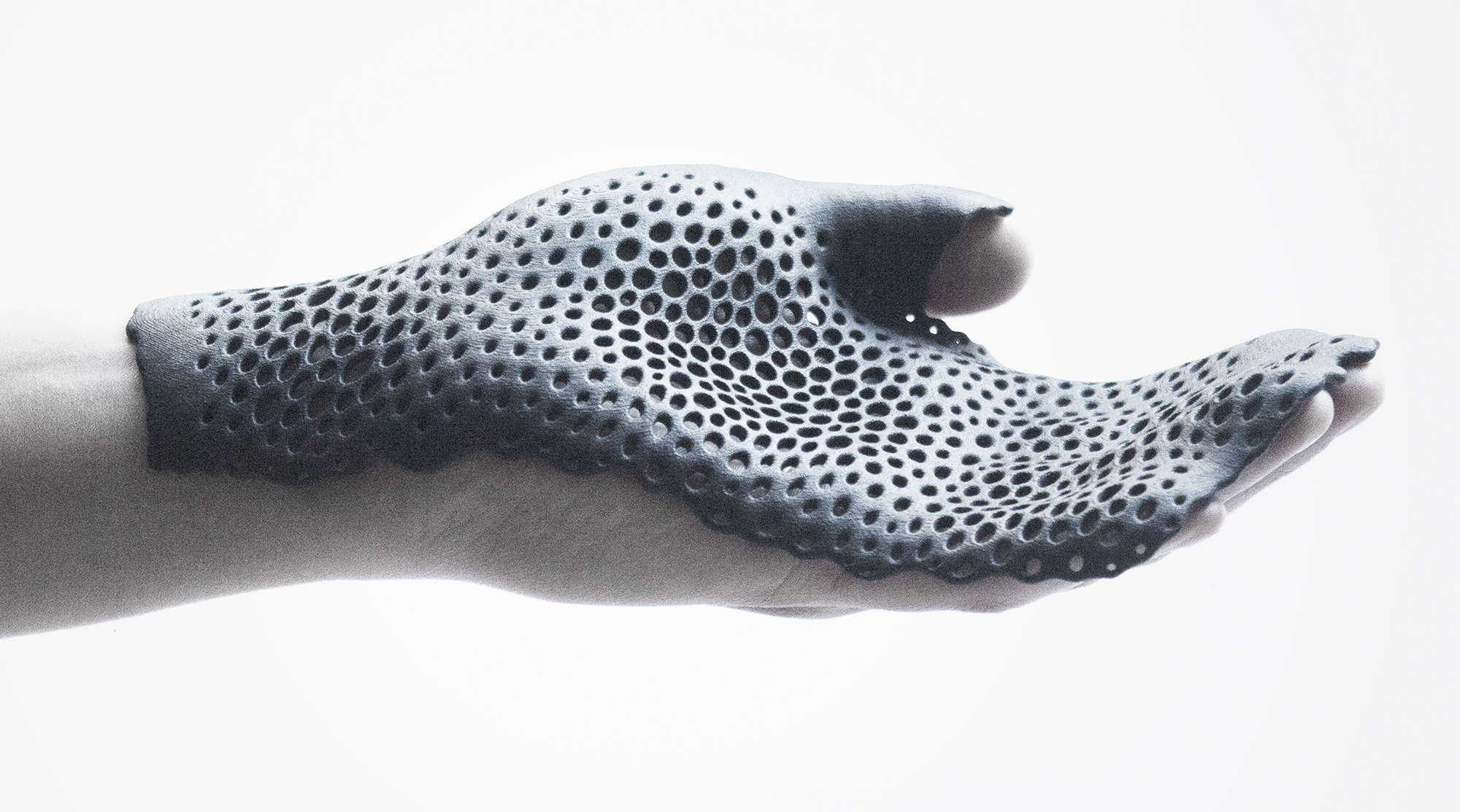 CID SPD18 MHOX GENERATIVE ORTHOSES HAND 1 2014 CREDIT MHOX